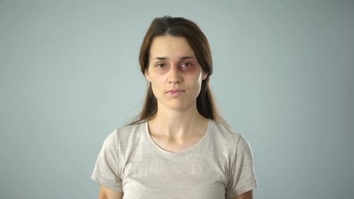Bruised Female Holding No Is No Sign, Putting End to Violence Against Women