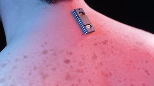Implanted Chip on the Back of a Man