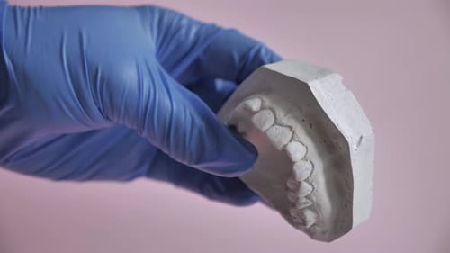 Dental Mold Examination with Gloved Hands
