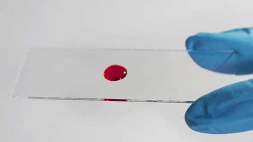 Laboratory Blood Test