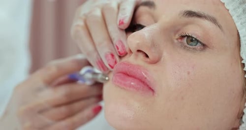 Woman Receives Lip Injection at a Medical Clinic