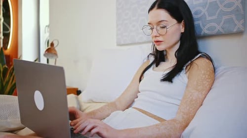 Junge Schriftstellerin mit ungleichmäßiger Pigmentierung trägt Brille tippt auf Laptop sitzt im Bett bei