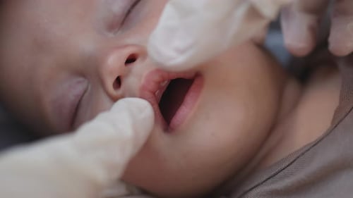 Les médecins vérifient les mains du bébé endormi, premier lait, dentition, dentition des gencives