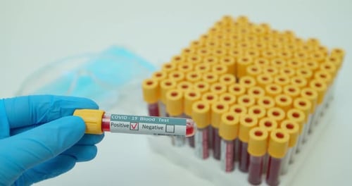 Forscher zeigt Röhrchen von Hand, positives Ergebnis der Blutuntersuchung auf Coronavirus, Covid-2.
