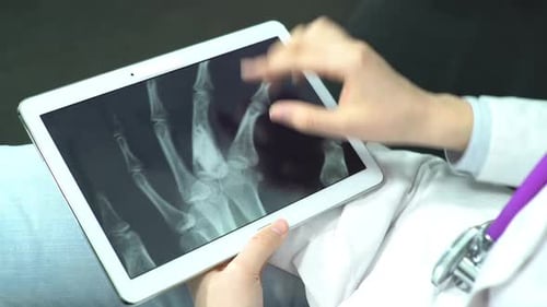 Doctor Examines X-Ray Scan on Tablet Device