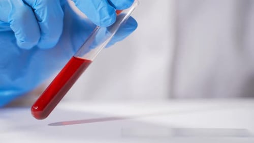 Coronavirus-Bluttest Labortechnikerin mit Schutzhandschuhen, die Pipette hält und testet