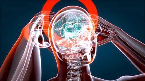 Animated Human Body X-ray Scan with Head Pain Highlight