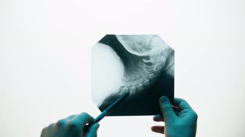 Neck Xray Closeup