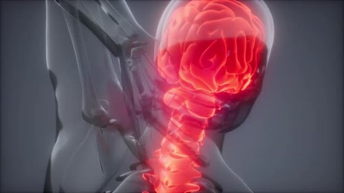 Backache in Back Bones