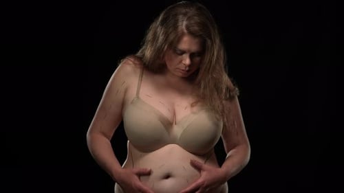 Woman in Bra Marked with Cosmetic Surgery Lines