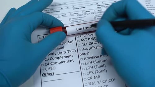 Liver Enzyme, Doctor Checking Name in Lab Blank, Showing Blood Sample in Tube
