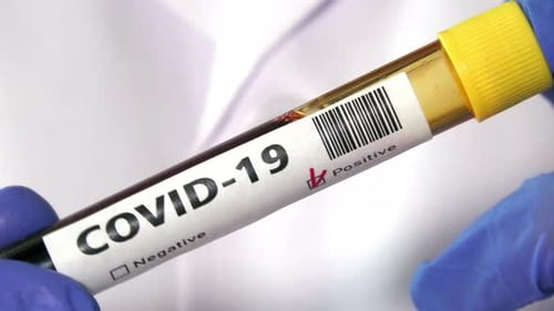 Coronavirus blood test
