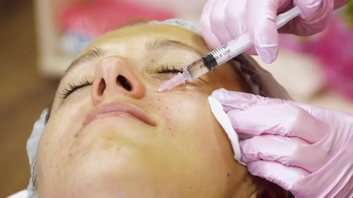 Woman Receiving Facial Injections in Medical Clinic