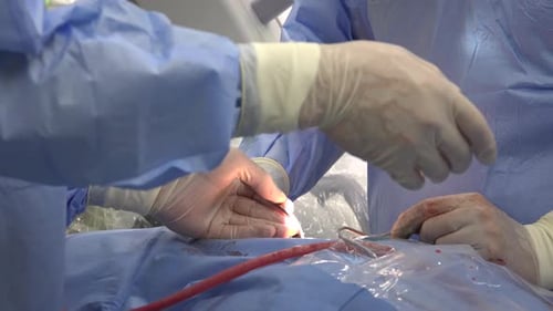 Surgeons Performing Operation in Hospital Operating Room