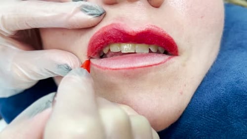 Woman Receiving Lip Cosmetic Procedure