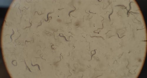 A Colony of Microorganisms, C-elegans Nematode Worms Under the Microscope, Macro