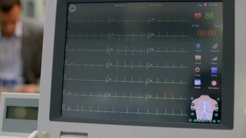 Medical Monitor Displaying Live ECG in Hospital Setting