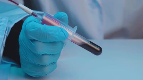 Blood Sampling for Test Blood Fills in the Test Tube Close Up
