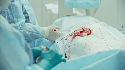 Coronary Artery Bypass Graft Surgery