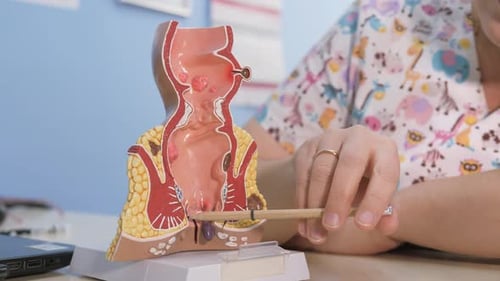 Proctologist Points Out the Pathology of the Rectum with a Pencil To the Anatomical Model
