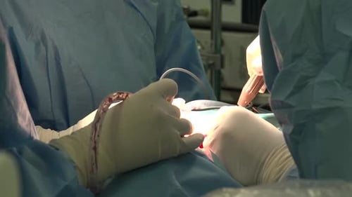 Surgeons Perform Open Incision Surgical Procedure in Hospital