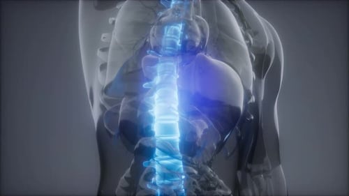 Backache in Back Bones