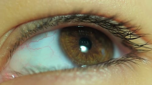 Eye