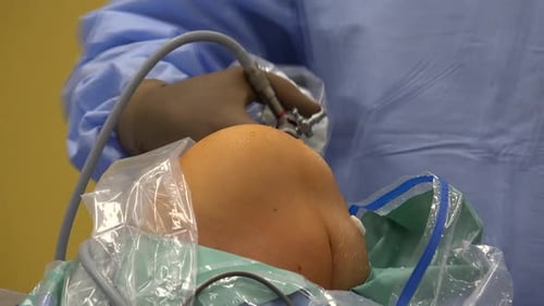 Medical Professional Performing Knee Surgery