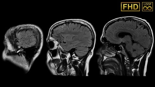 Rotating Human Brain MRI Scan Loop