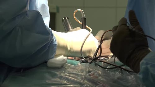 Surgeons Perform Medical Procedure in Operating Room