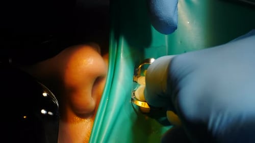 Dentist Works on Patient's Teeth Close Up