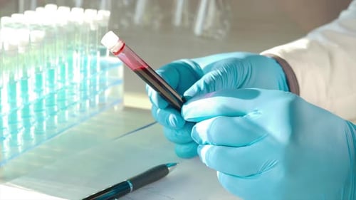 Scientist Examining Blood Sample in Laboratory