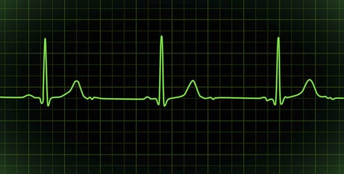 Herzschlagmonitor, EKG-Kardiogramm, schleifbar