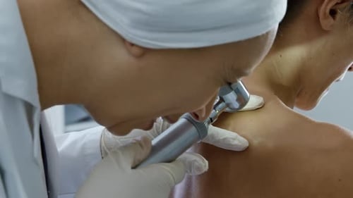 Doctor Using Dermatoscope Inspects Patient's Skin