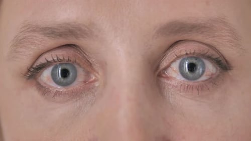 Blinking Eyes of Aged Woman
