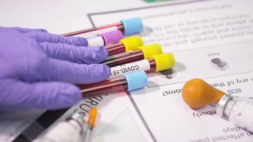 Coronavirus Test