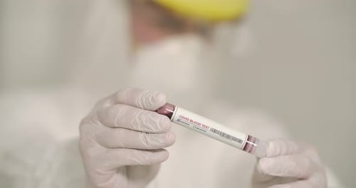 Positive Covid Blood Test in the Laboratory