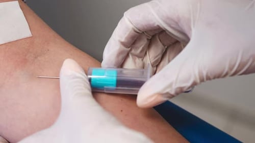 Filling a Test Tube with Blood