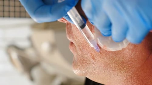 Facial Filler Injection Procedure at Doctor's Office