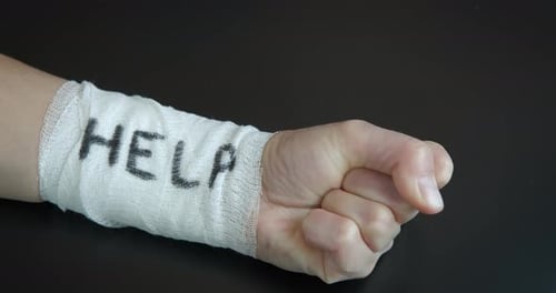 Bandaged arm with the word 'HELP' written on it