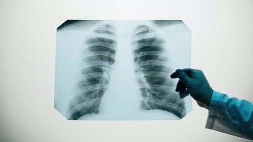 Examining Chest X-Ray for Medical Diagnosis