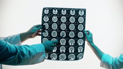 Medical Professional Examines Brain Scan in Hospital