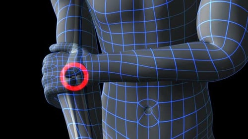 Human Elbow Pain Medical Animation with Wireframe Grid