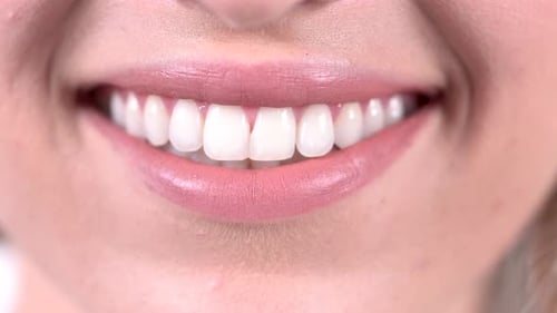 Close Up of Woman Smiling Showing White Teeth