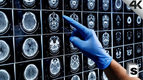Medical Professional Analyzing Brain Scan Imagery