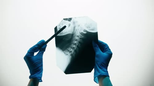 Neck Xray Closeup