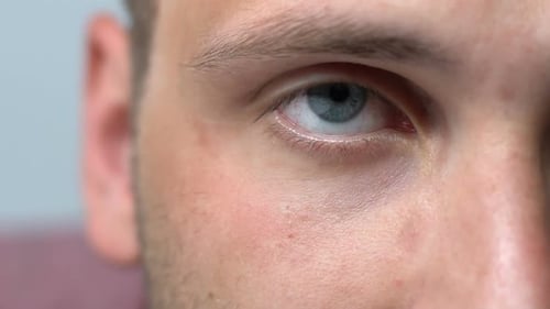 Junger Mann blickt in die Kamera, leidet unter Überanstrengung der Augen und roten Augen, Müdigkeit