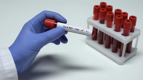 Negativer Grippe-RSV-Test, Arzt zeigt Blutprobe, Laborforschung, Gesundheitsuntersuchung