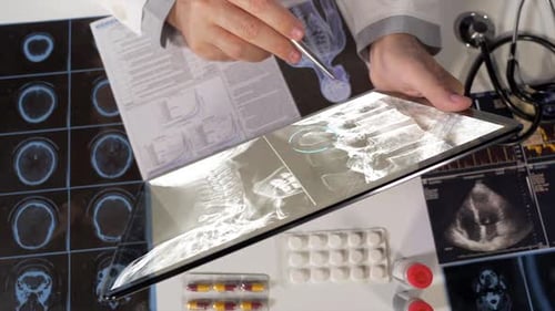 Doctor Examining X-Ray Image on Tablet