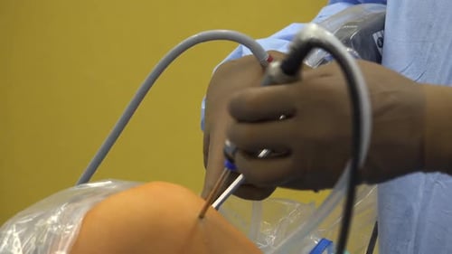 Surgeon Performing Minimally Invasive Knee Surgery